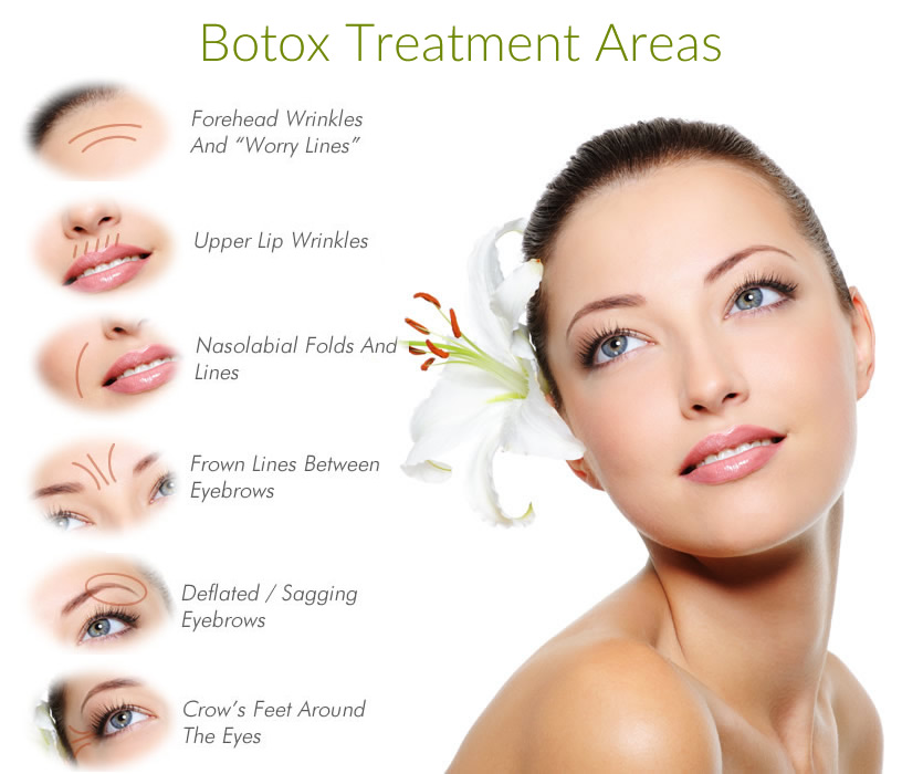 Allergan Botox 