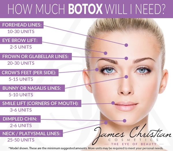 how much does face slimming botox cost