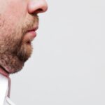 Kybella VS Liposuction: Which Degrades the Double Chin Better?