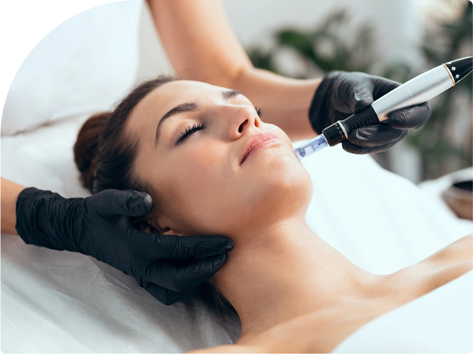 What is Dermapen treatment in NYC Banner